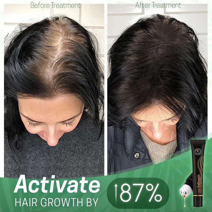 PureRoot™ — Revive Your Hair’s Full Glory with Nourishing Organic Power