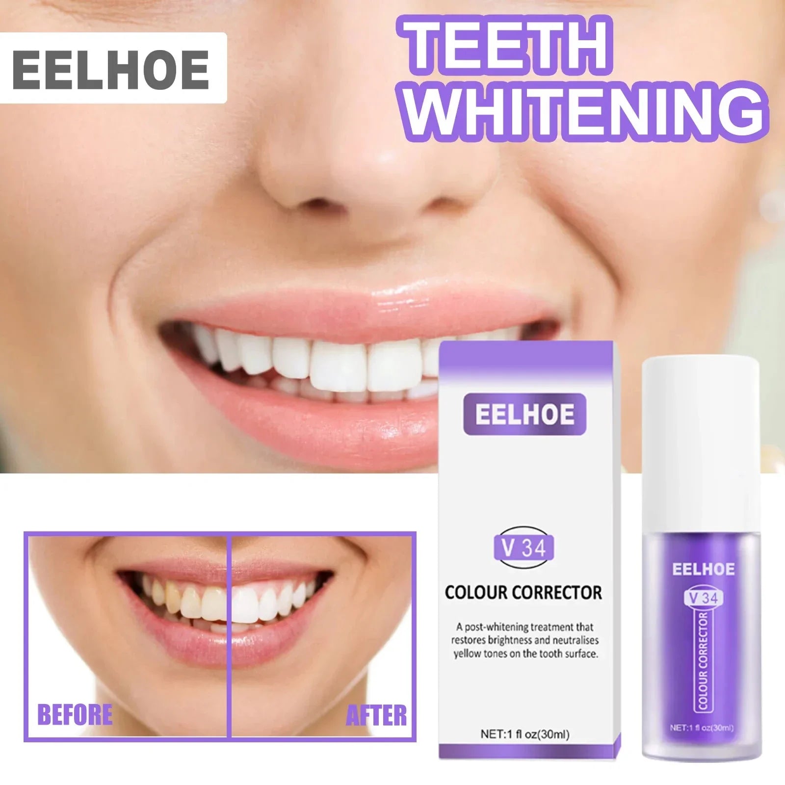 RadiantMist™ Serum — Instantly Brighten Your Smile Without Pain or Sensitivity