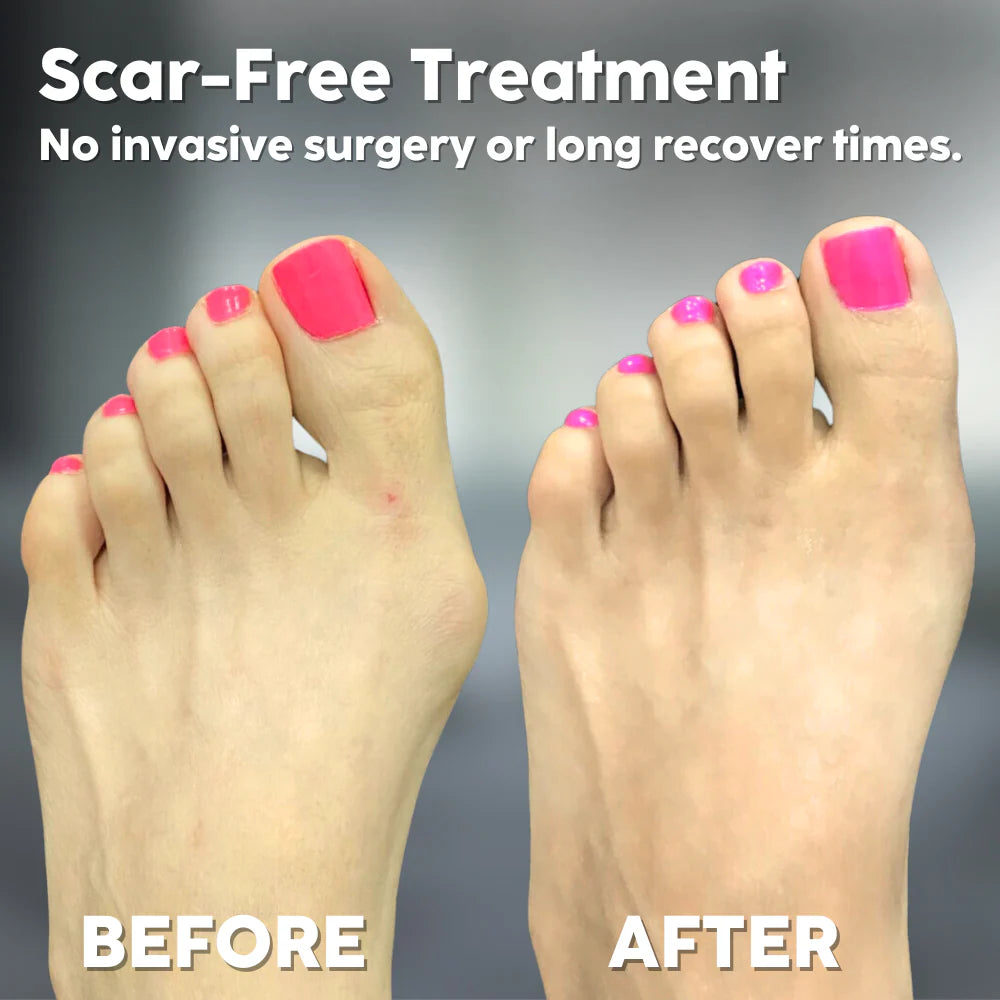 SilhouStep™ — Rediscover Pain-Free Steps and Freedom to Move