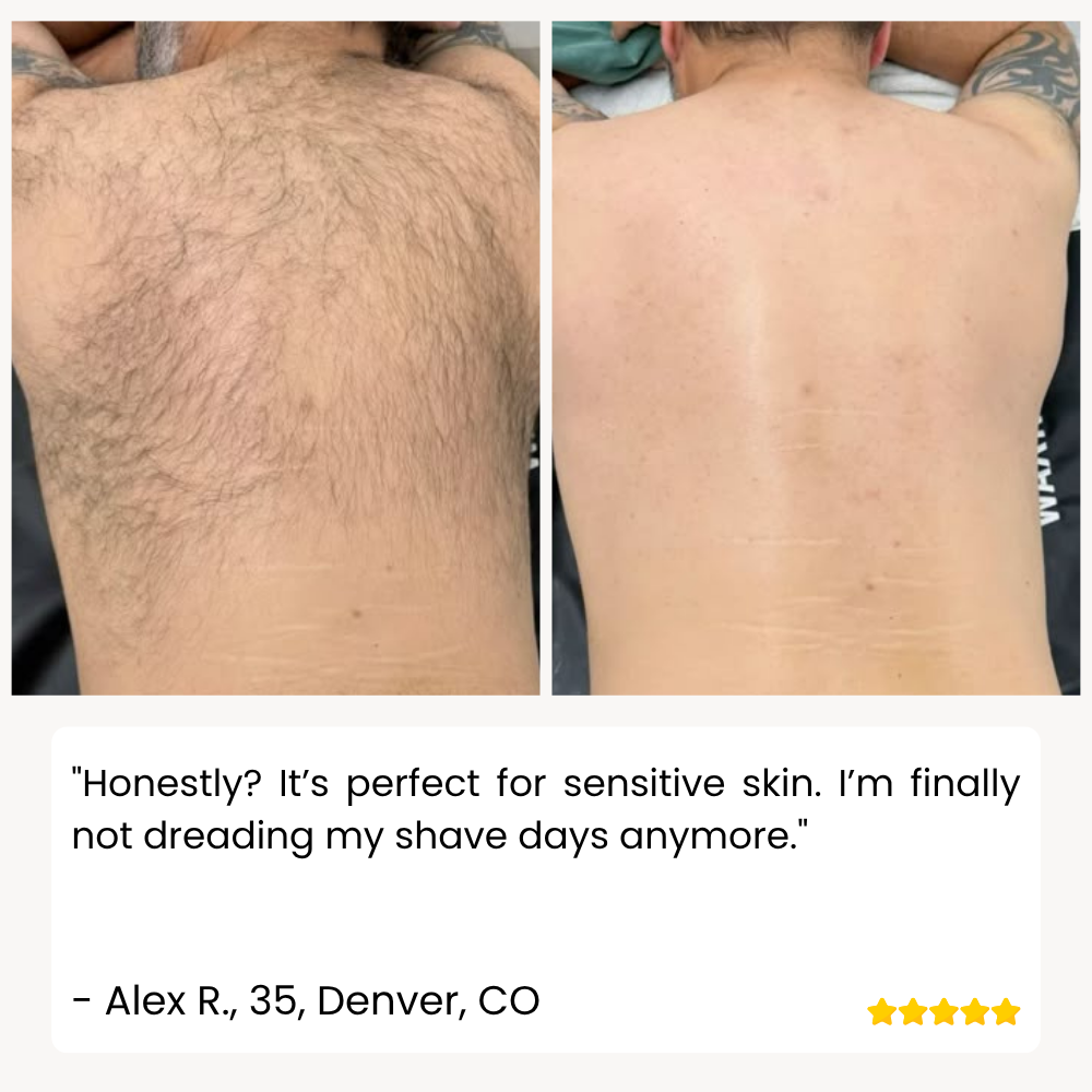 RamoxoPro™ — Effortless Precision Shaving That Leaves Your Skin Silky-Smooth and Irritation-Free