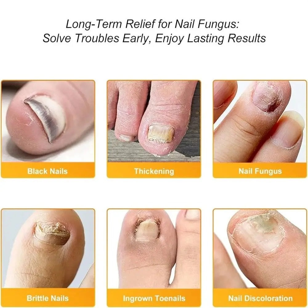 VitaNail Restore™ — Finally Reveal Clear, Strong Nails That Boost Your Confidence Every Day