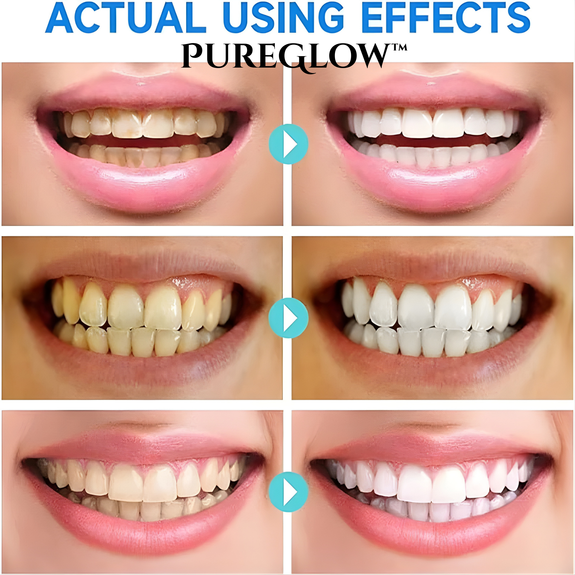 VivaLustre™ — Unleash a Radiant Smile That’s Strong, Fresh, and Confident in Just Days
