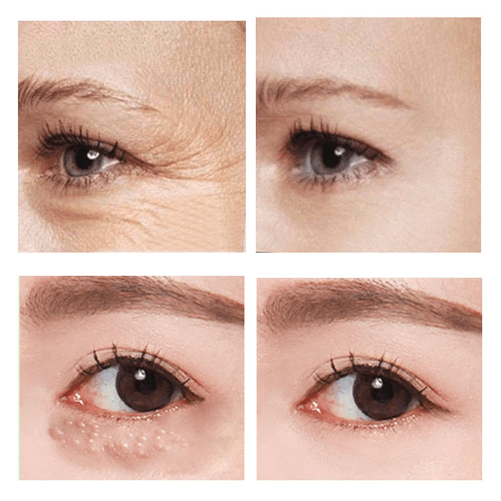 LumiFirm™ — Instantly Erase Puffiness for Bright, Youthful Eyes That Turn Heads