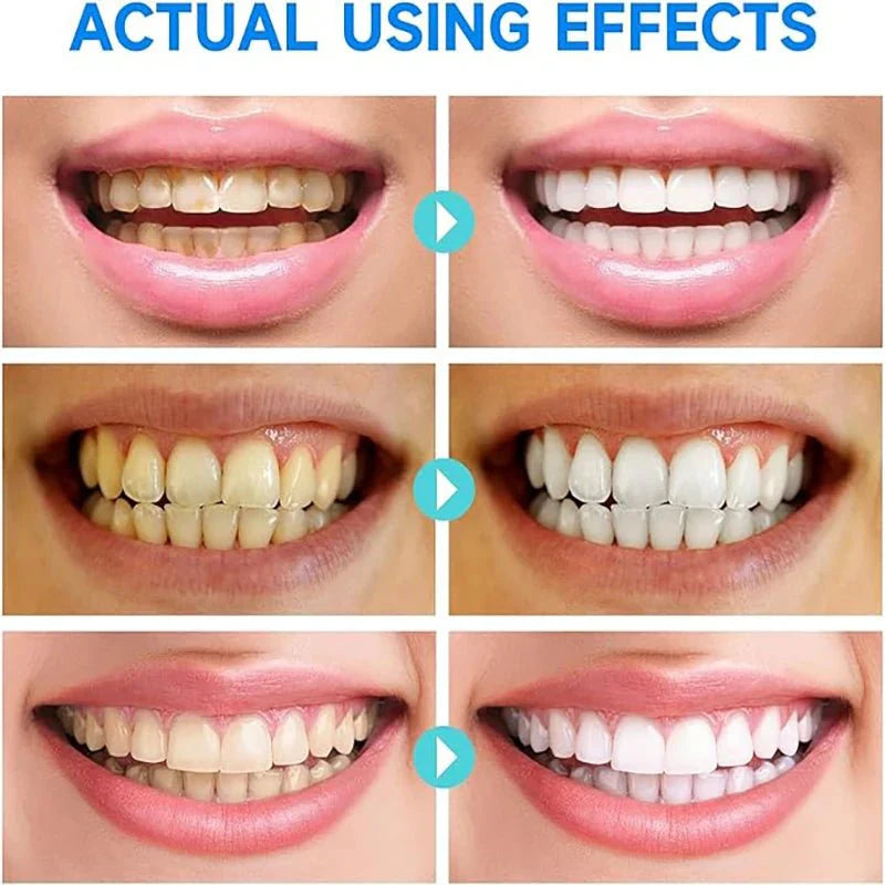 LumaShine™ — Unleash a Radiant Smile That Boosts Your Confidence Every Day