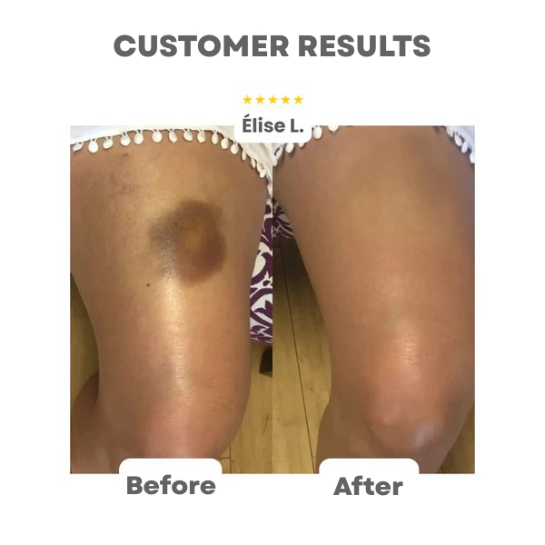 RadianceRush™ — Instant Flawless Glow That Boosts Your Confidence All Day