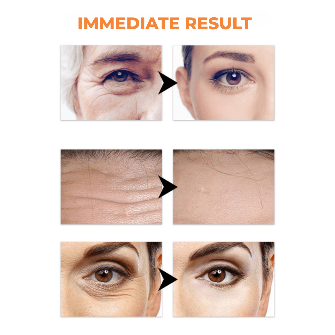 RejuvaRise™ — Snap Back to Youthful, Radiant Skin in Days
