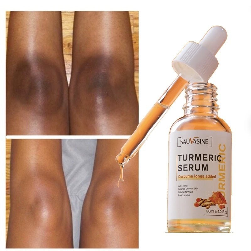 LumaRadiance™ Serum — Unleash Your Glow by Melting Away Dark Spots Fast