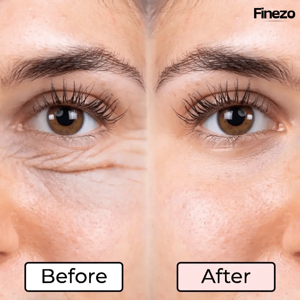 RadiAura™ — Instantly Revive Tired Eyes for a Radiant, Youthful Glow