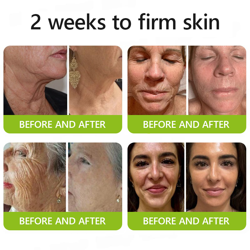 LysoriaLift™ — Reveal Firmer, Radiant Skin That Turns Back Time Without Needles
