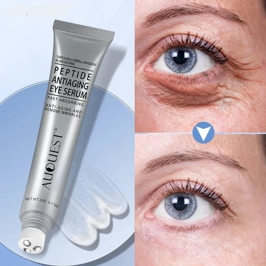 Anti-Aging Eye Cream for Dark Circles and Wrinkles – Hydrating Formula