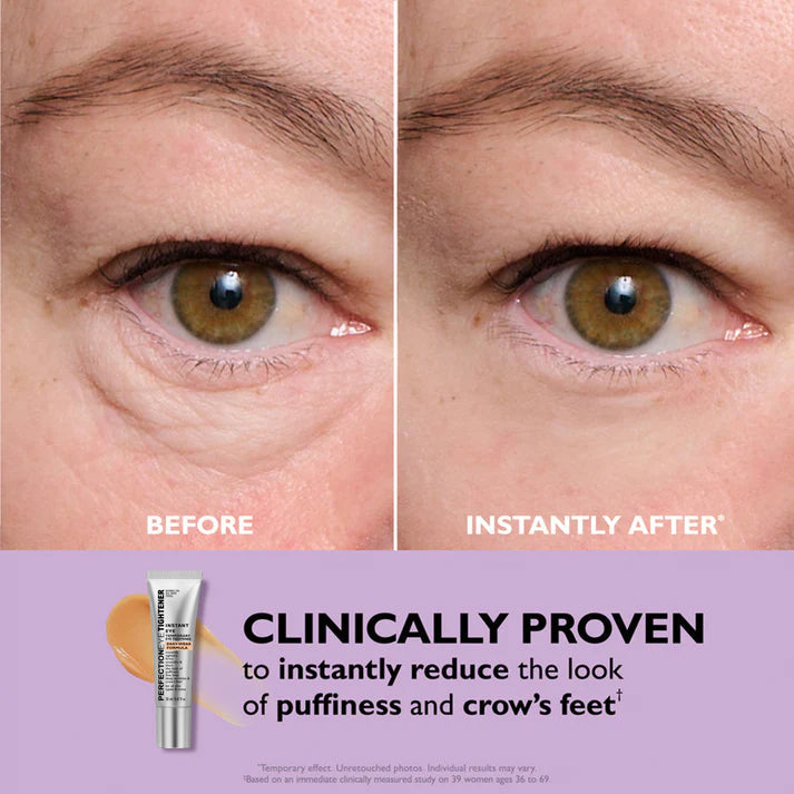 Eye Cream for Dark Circles & Wrinkles | Instant Fresh Look