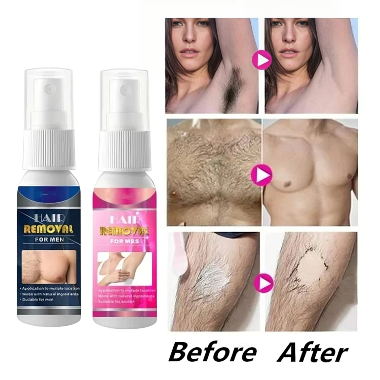 Hair Removal Spray - BareMist Formula