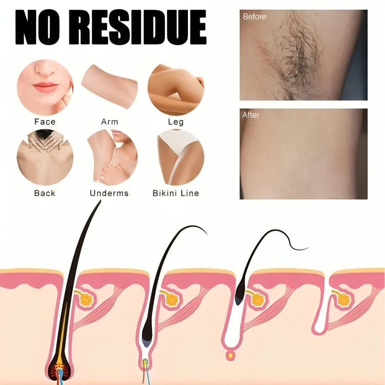 Hair Removal Spray - BareMist Formula