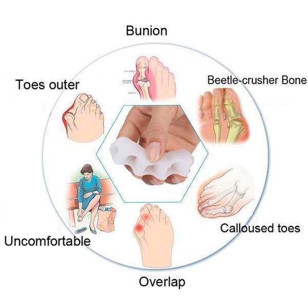 AlignEase – Comfortable Toe Alignment Solution
