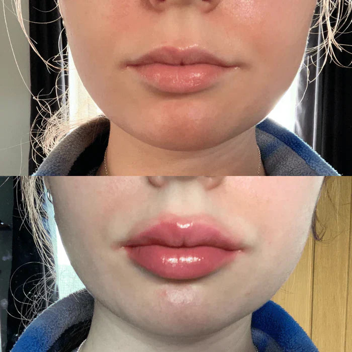 Luxe Lip Enhancer Serum for Voluminous Lips
