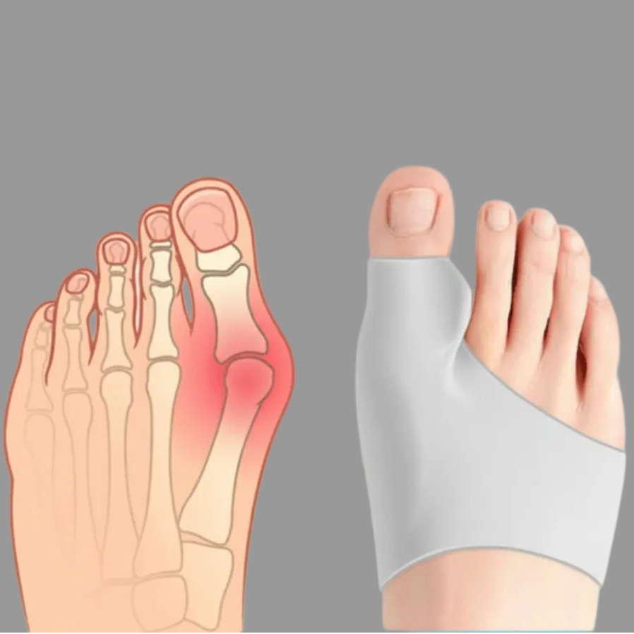 Hallux Valgus Support and Corrector for Daily Comfort