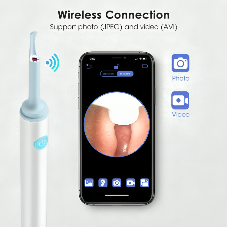Effortless Earwax Removal with Real-Time Visualization Device