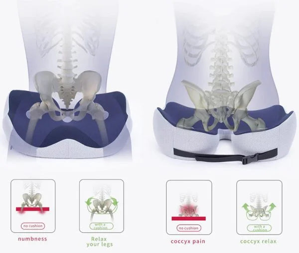 ErgoCushion – Ultimate Relief for Tailbone Discomfort