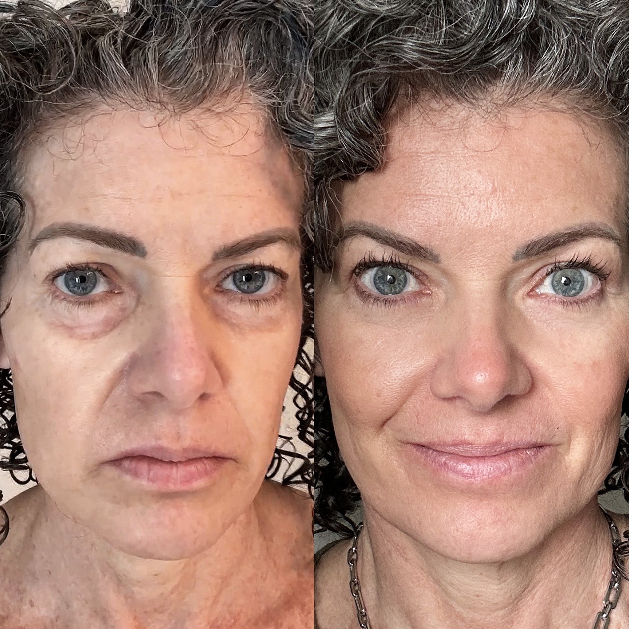 Goodbye Dark Circles and Puffiness with EyeRevive Solution