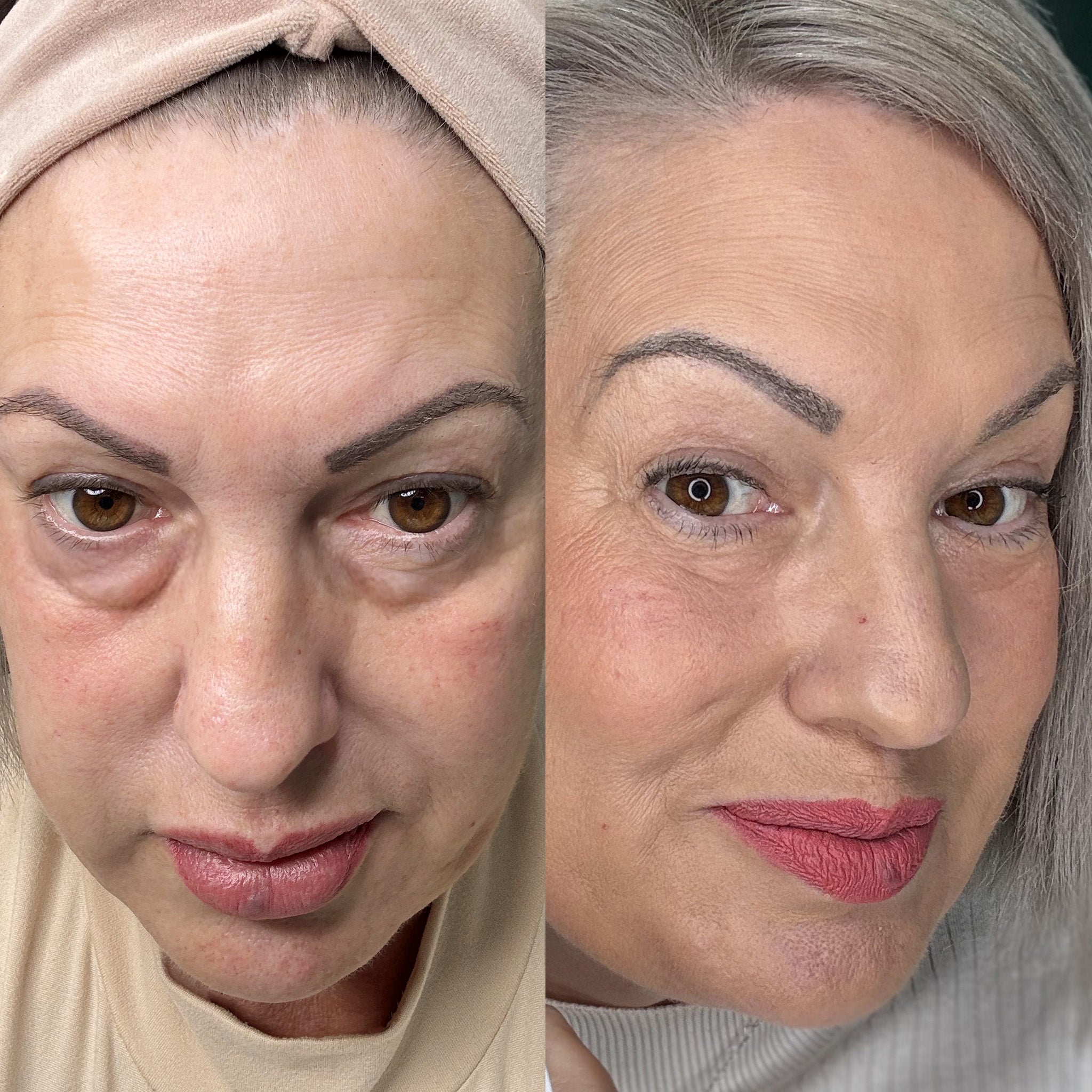Goodbye Dark Circles and Puffiness with EyeRevive Solution