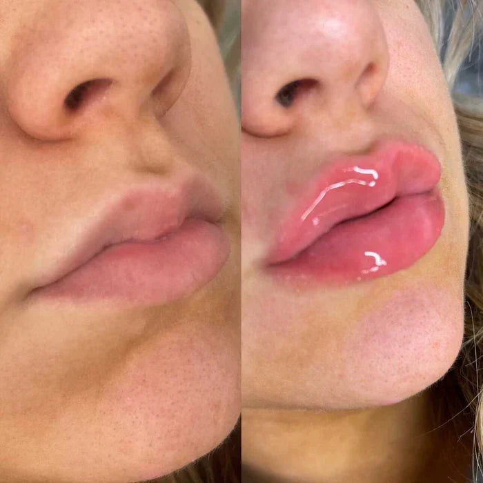 Luxe Lip Enhancer Serum for Voluminous Lips