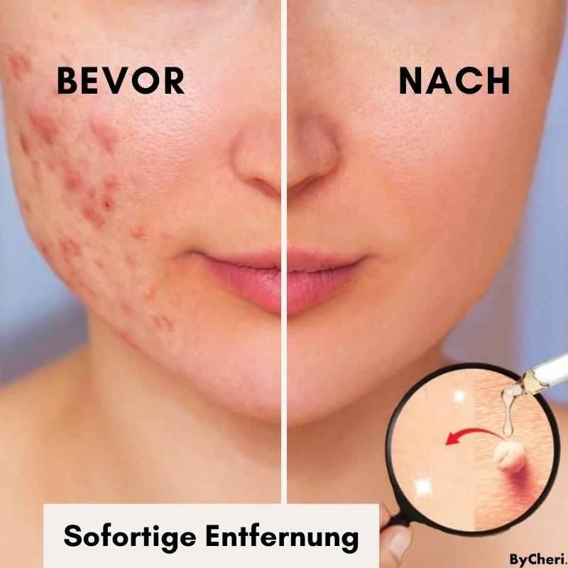 Say Goodbye to Skin Imperfections with Flawless Fade
