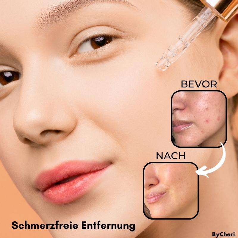 Say Goodbye to Skin Imperfections with Flawless Fade
