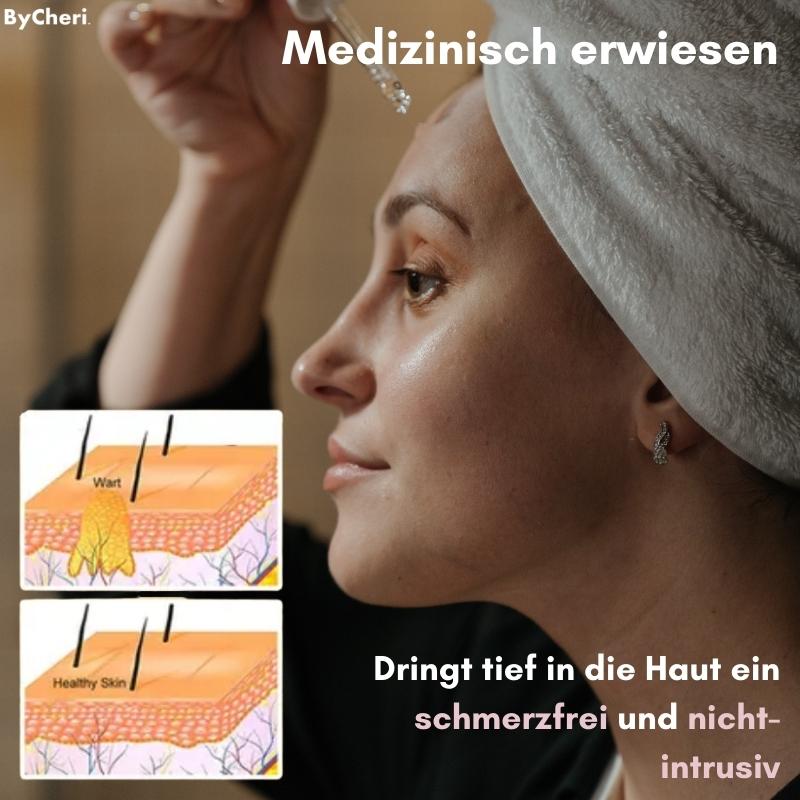 Say Goodbye to Skin Imperfections with Flawless Fade