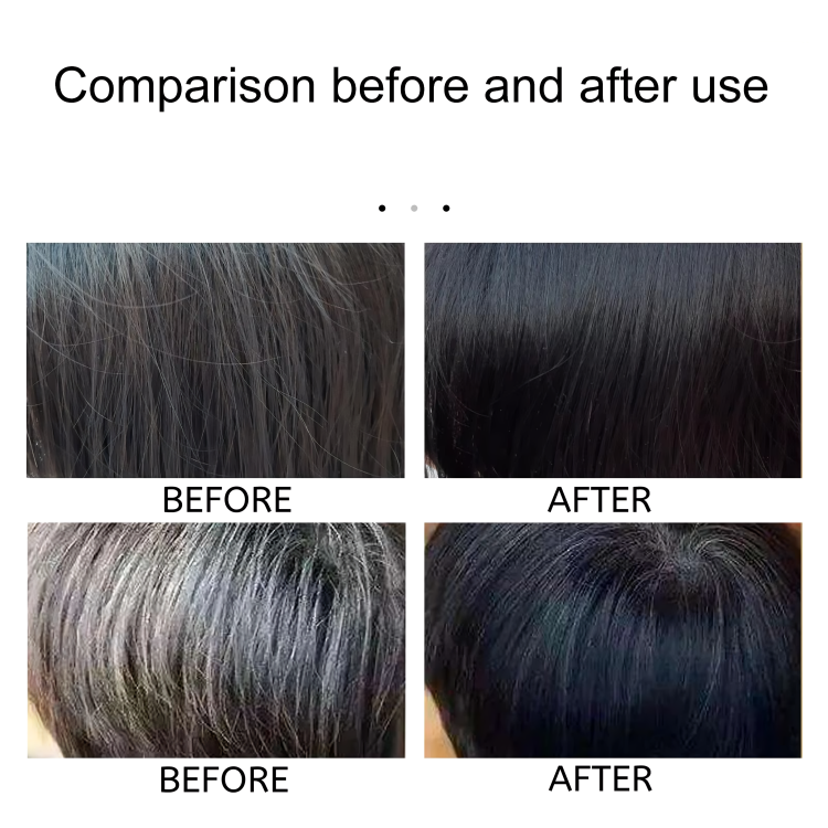 Restore Your Natural Hair Color – GrayAway Solution