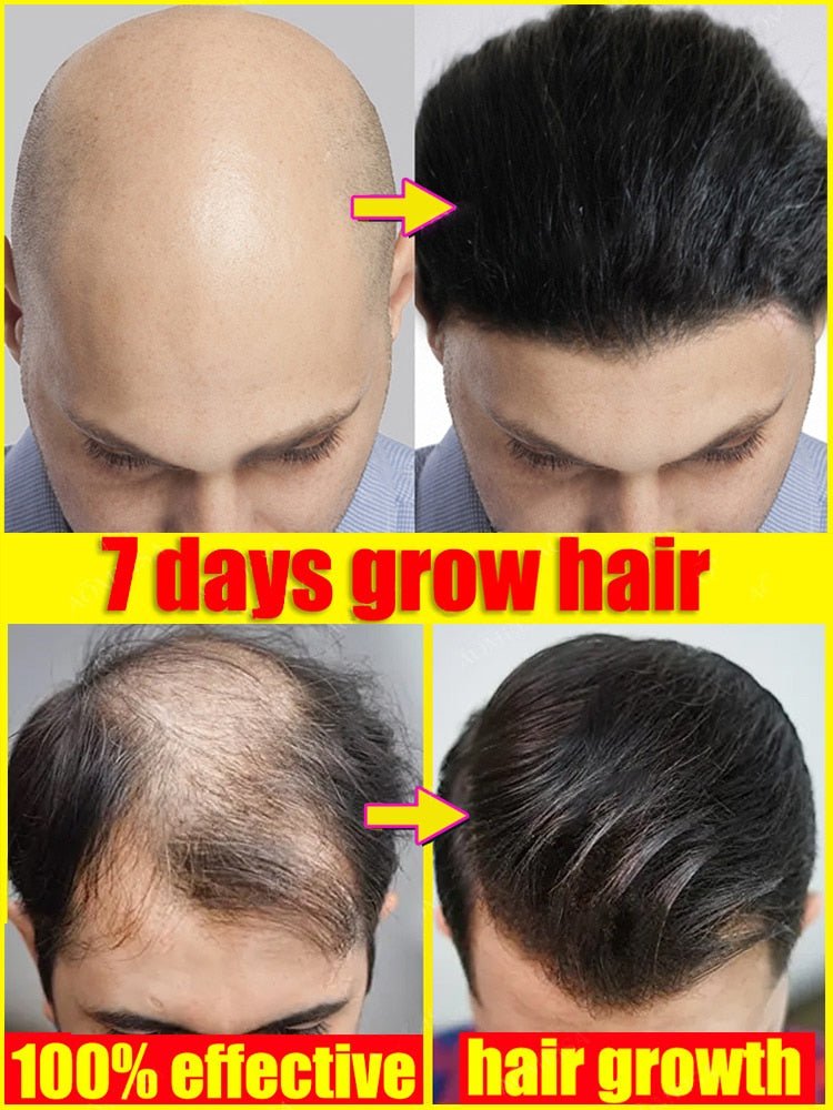 Scalp Hair Oil | Nourishes Scalp and Hair Roots | Promotes Thicker Hair Feel
