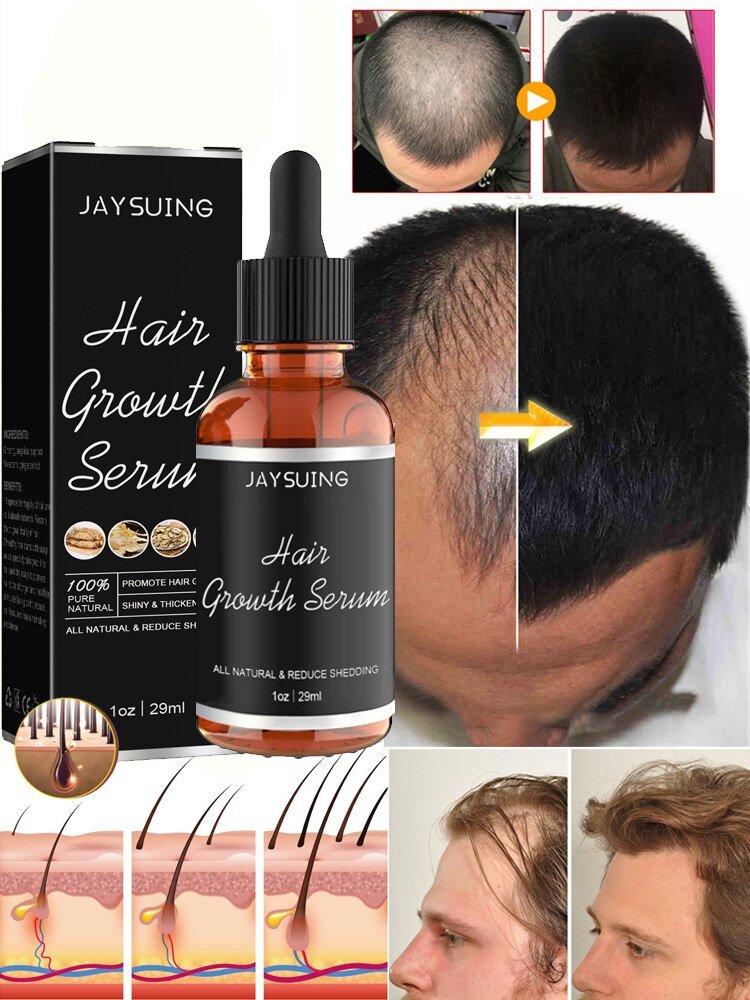Scalp Hair Oil | Nourishes Scalp and Hair Roots | Promotes Thicker Hair Feel