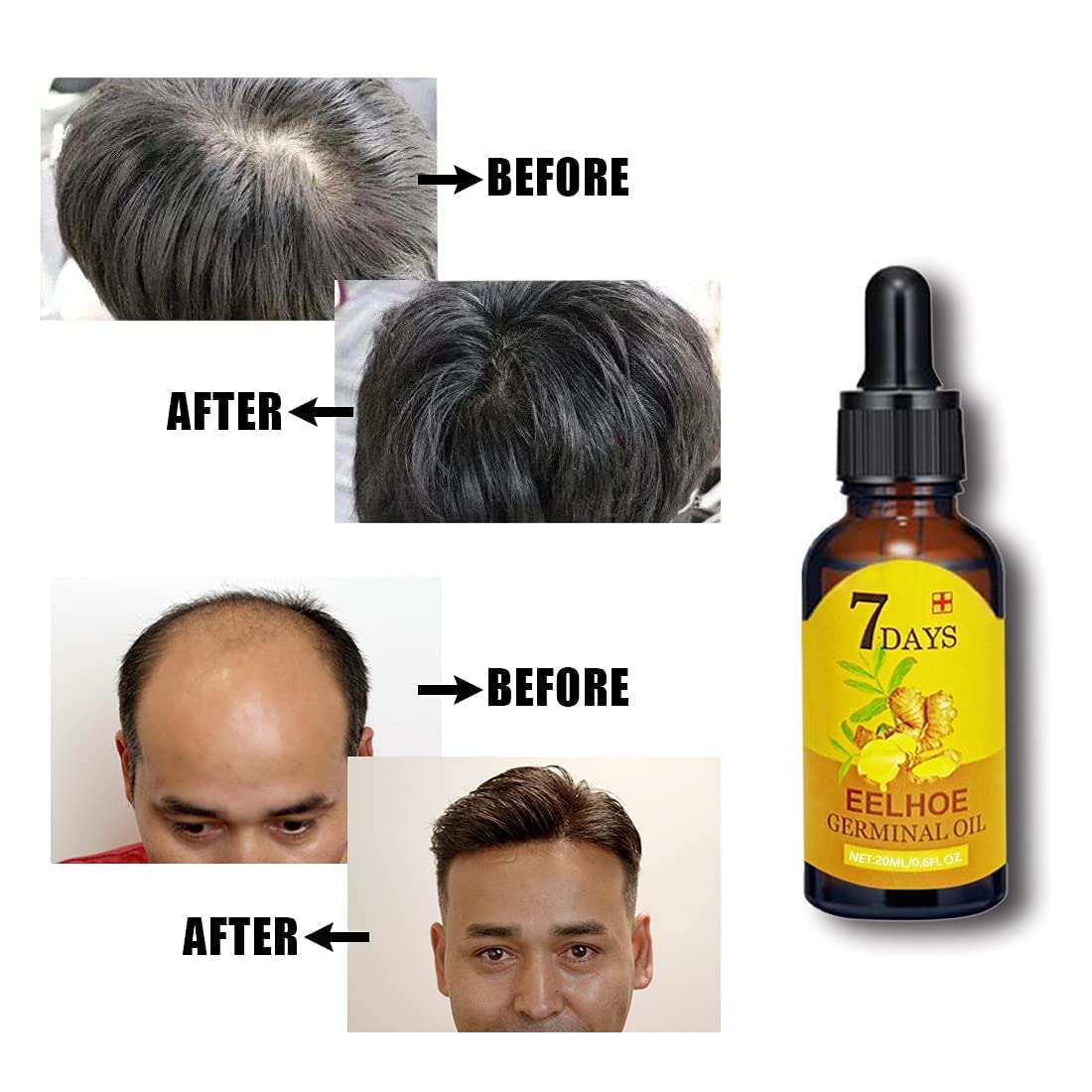 Hair Growth Scalp Care Activator - Strengthening Root Formula