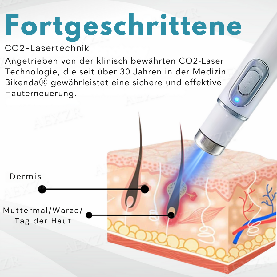 Skin Rejuvenation Pen | Accurate Skin Correction | Non-Invasive Plasma Technology