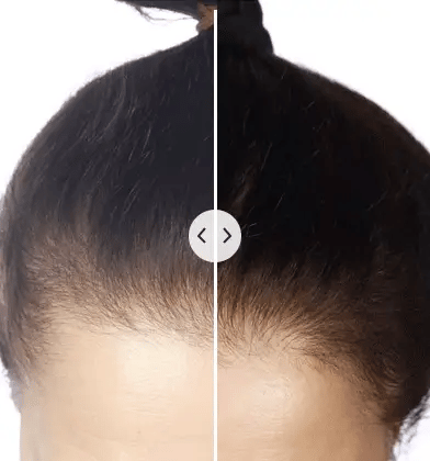 Electric Hair Revitalizer for Relaxation
