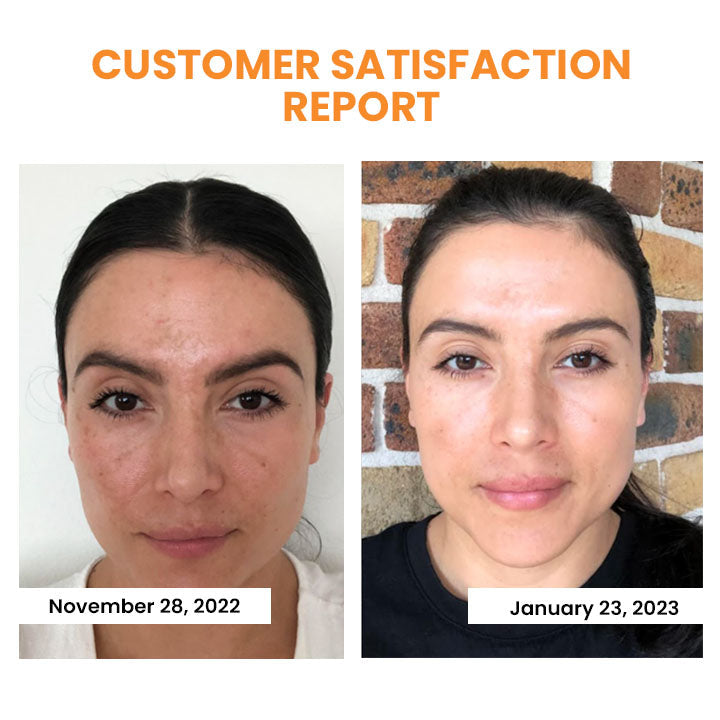 Soluble Collagen Film with Korean Dermalayer Technology
