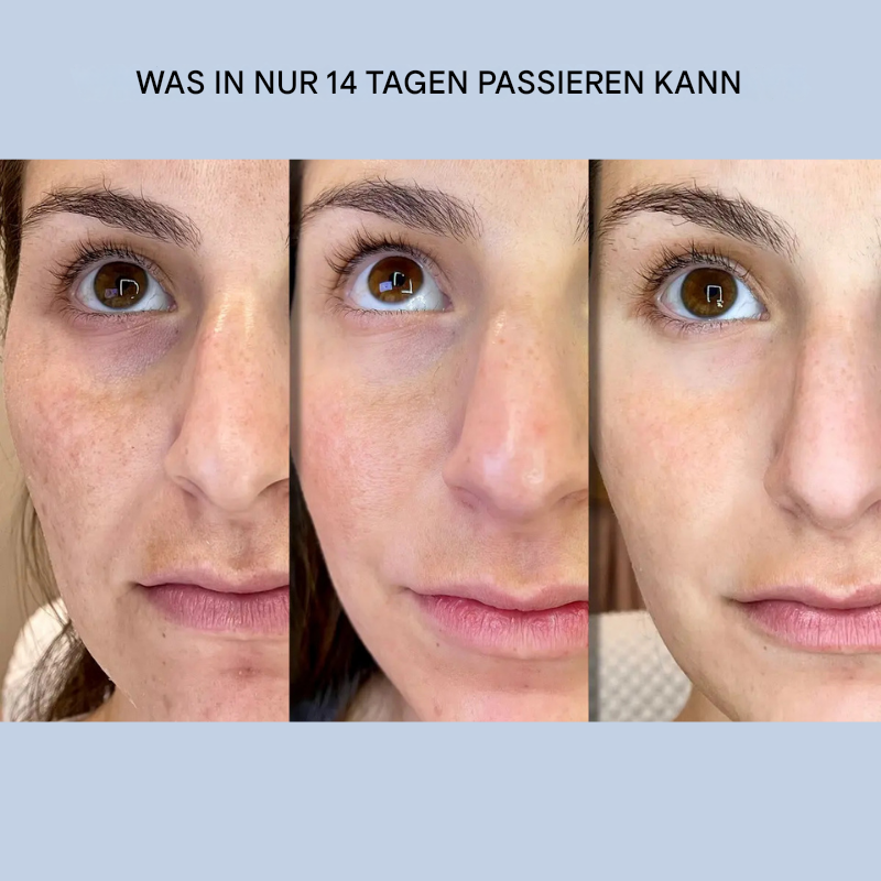 Facial Lifting Strips | Instant Smoothing & Tightening | Non-Surgical Anti-Aging Care