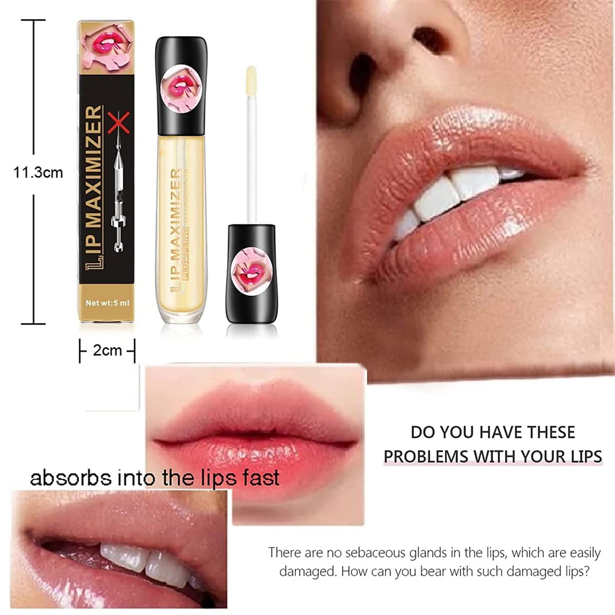 Achieve Beautiful Lips Instantly!