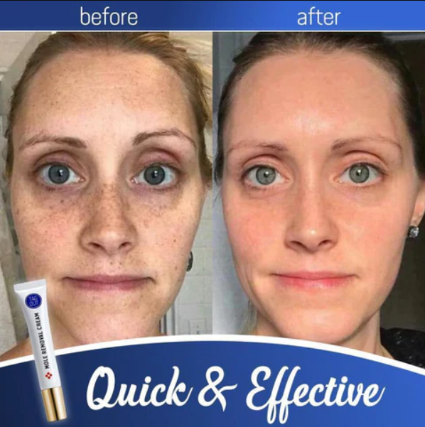 Radiance Cream - Achieve Glowing Skin