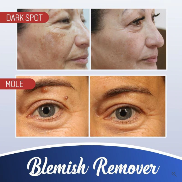 Radiance Cream - Achieve Glowing Skin
