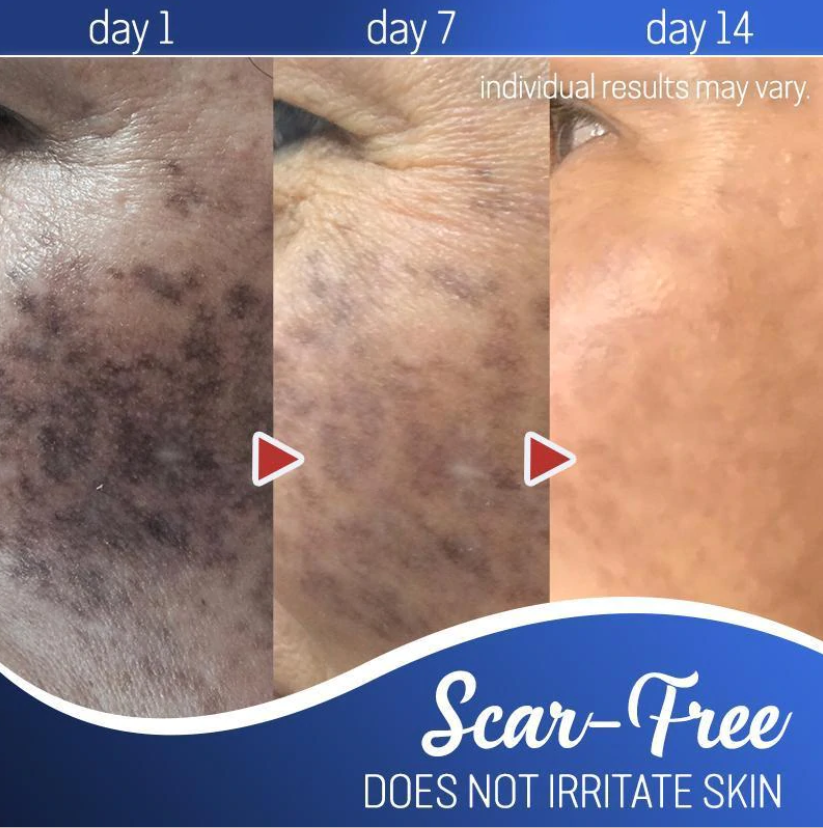 Radiance Cream - Achieve Glowing Skin