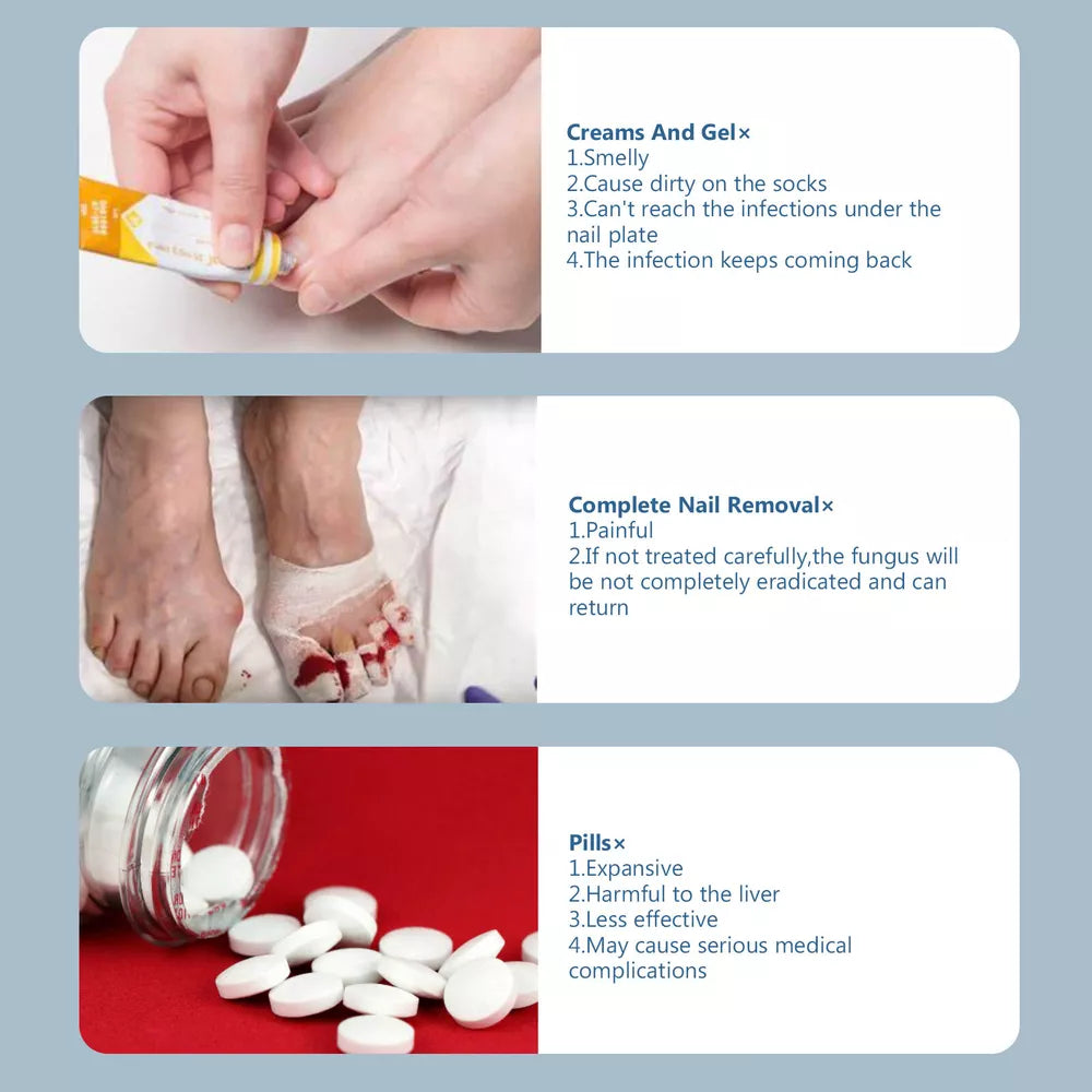 Effective Laser Treatment Device for Nail Fungus Relief