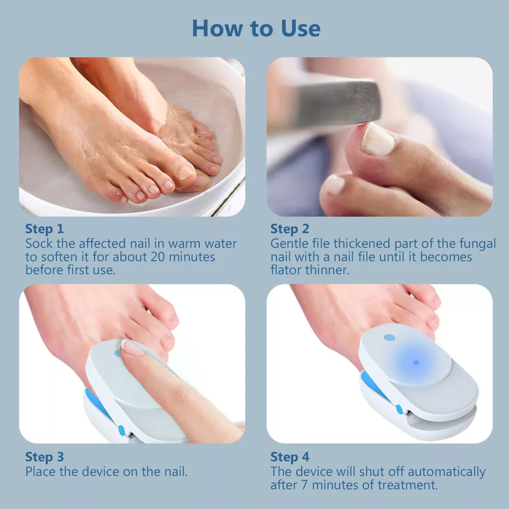 Effective Laser Treatment Device for Nail Fungus Relief