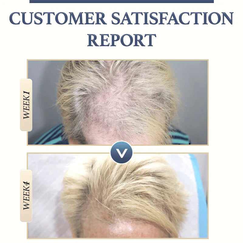 Natural Hair Growth Shampoo | Reduces Hair Loss | Gentle Scalp Care