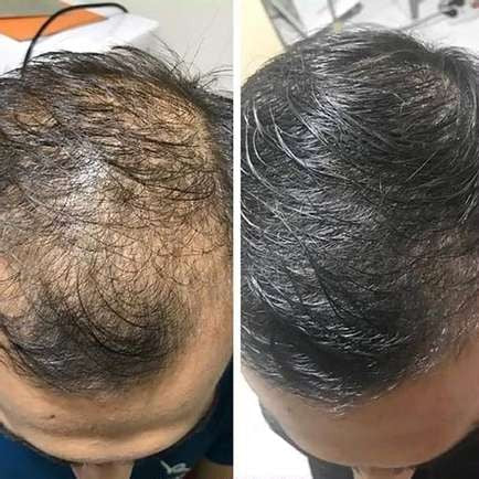 Natural Hair Growth Shampoo | Reduces Hair Loss | Gentle Scalp Care