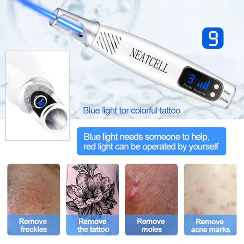 Home Laser Solution for Tattoo and Skin Blemish Removal