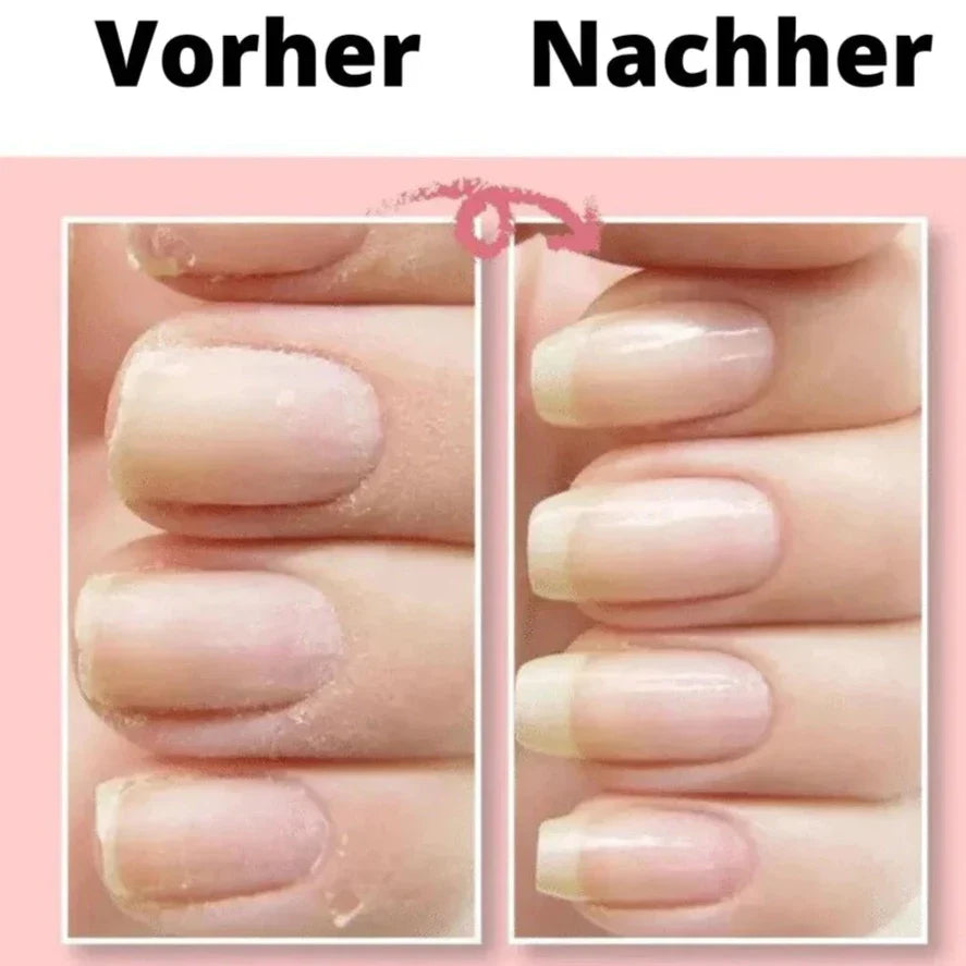 Easy Nail Repair Gel for Beautiful Nails