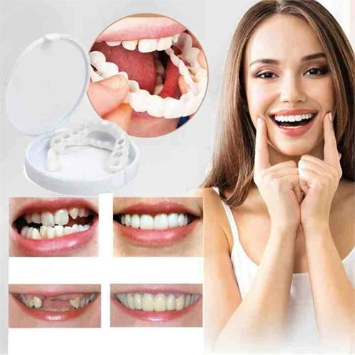 Snap-On Denture with Adjustable Fit | Tooth Prosthesis