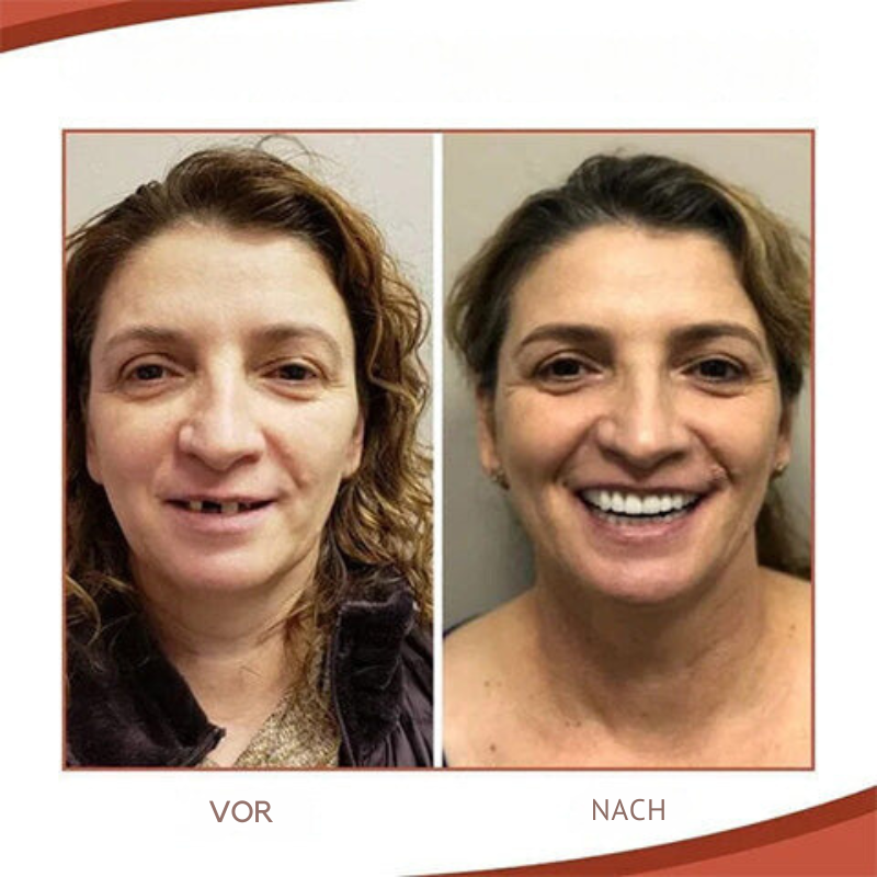 Dentures | Secure Fit & Natural Smile Adjustment