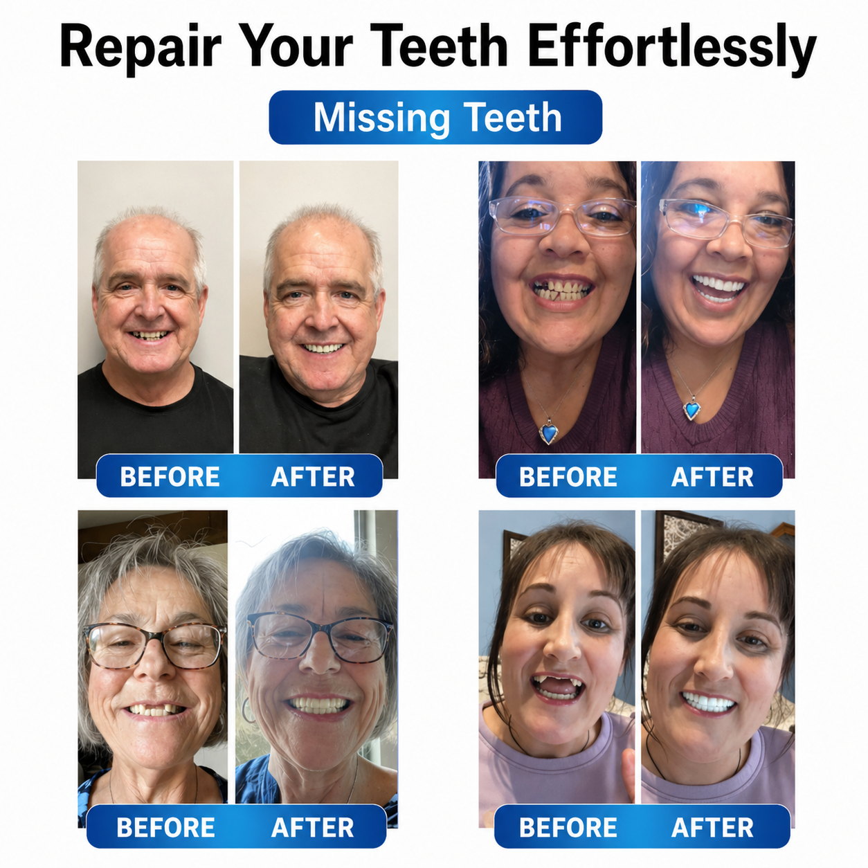 Denture Repair Kit with LED Light | Malleable Tooth Gel