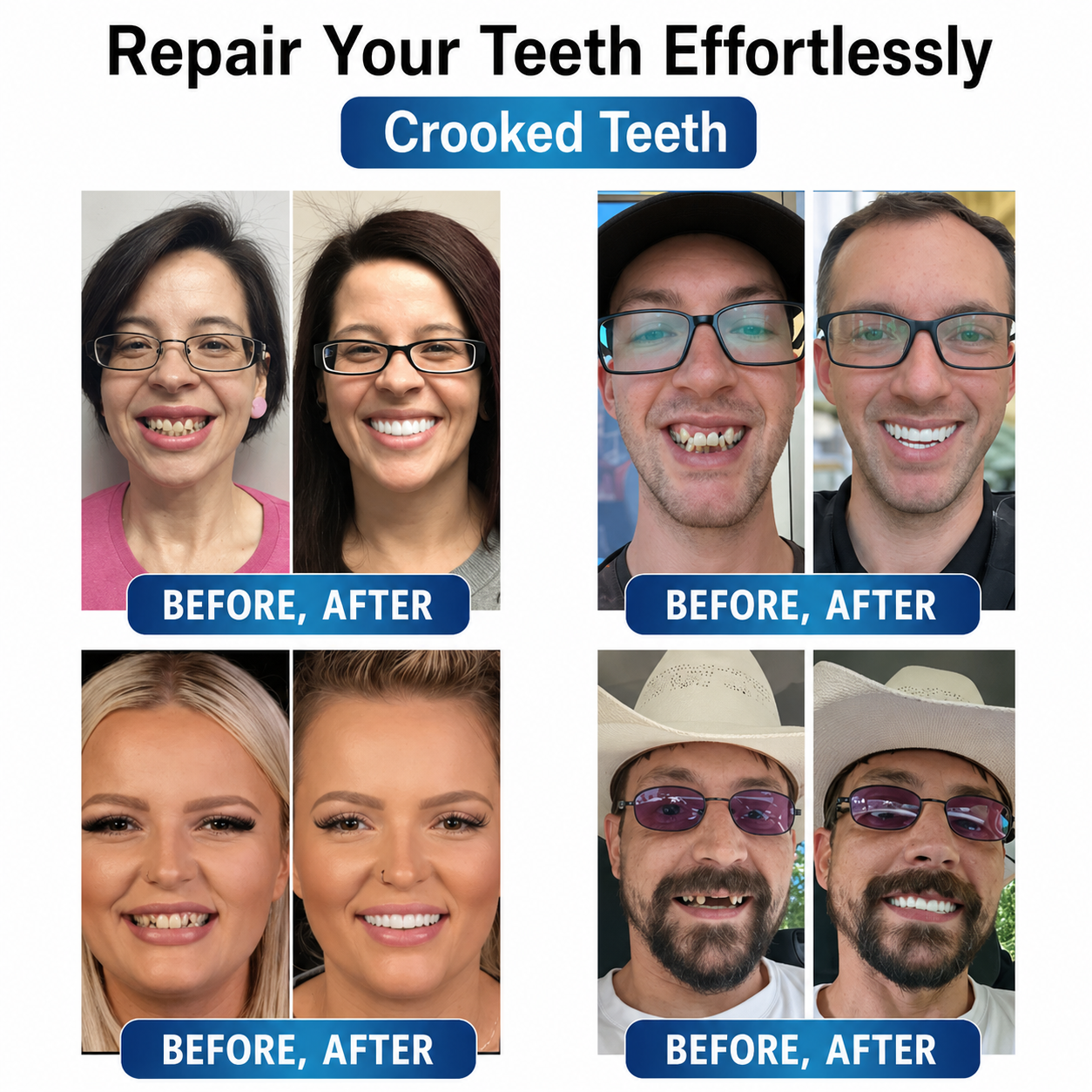 Denture Repair Kit with LED Light | Malleable Tooth Gel